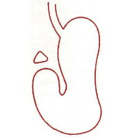 サンビー 人体略図ゴム印 胃14 『胃』 JING-14  1個（取寄品）