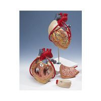京都科学 心臓モデル（バイパス付） G06 1台 11-2130-00（直送品）