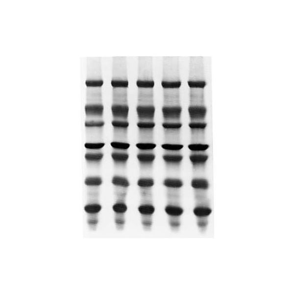 ImmobilonーPSQ PVDF 0.2μm 20x20cm sheet 10/Pk 10PK ISEQ20200 1個(10個)（直送品）