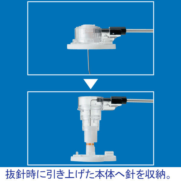 トップ ファインガードノンコアニードル22G×15mm100mm 18307 1箱