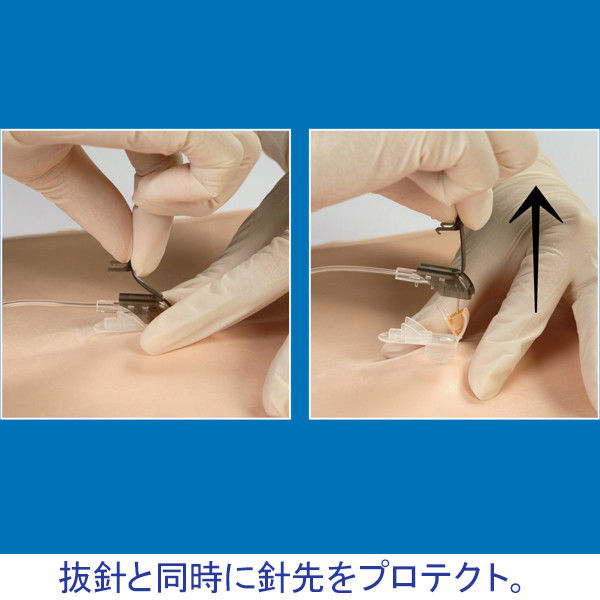 ニプロ セーフタッチコアレスニードル(R)セット セーフタッチ ニプロ セーフタッチコアレスニードル(R)セット セーフタッチ