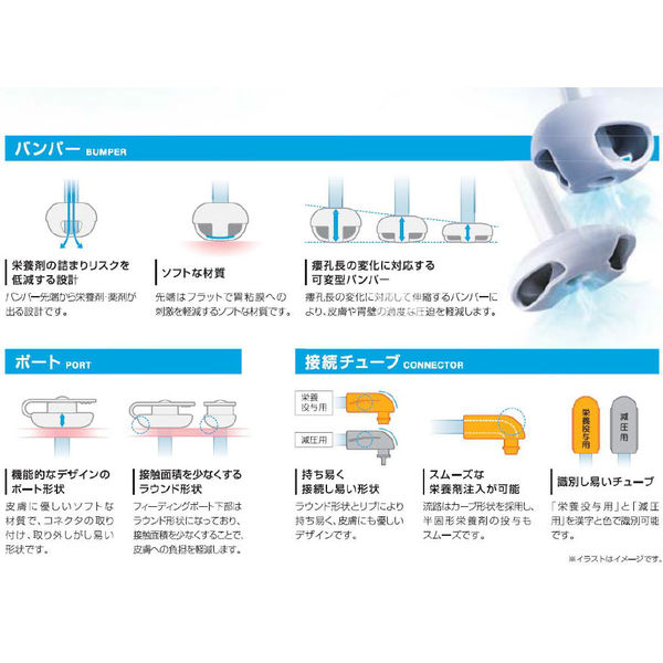 トップ 胃瘻交換ボタン アイボタンR （24Fr./3.5cm）ワイヤ有 24133 1箱（1キット入）（取寄品） - アスクル