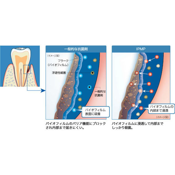 歯科医院取扱品 デンタルペーストα 90g 1セット（2本） ライオン(LION) 歯周病予防 歯磨き粉  アスクル