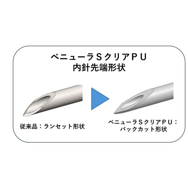 トップ べニューラSクリア 22G×25mm（PU） 01166 1箱（50本入