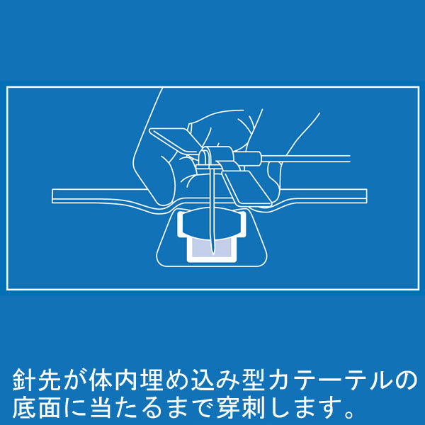 ニプロ コアレスニードルセット CFW20G×3/4”(19mm)-100mm 24251