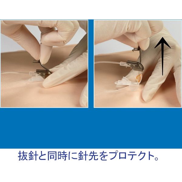 ニプロ セーフタッチコアレスニードルセット STC-24G×3/4”(19mm