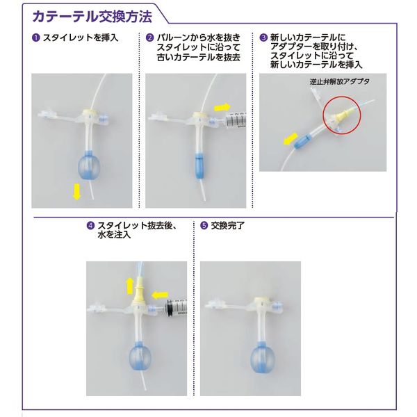 ニプロ ＧＢ胃瘻バルーンカテーテル/ISO（ボタン型）【交換キット】18Fr.×34mm 60479 1箱（1キット入）（取寄品） - アスクル