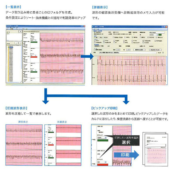 オムロンヘルスケア 判読支援ソフト（HCG-801/901専用ソフト） HCG-SOFT-CL1 1個（取寄品） - アスクル