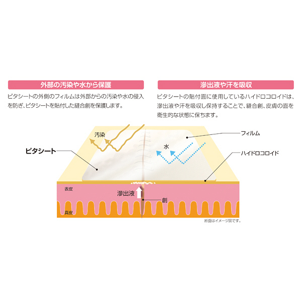 アルケア ピタシート ソフト 19001 1箱（3枚入） （取寄品） - アスクル