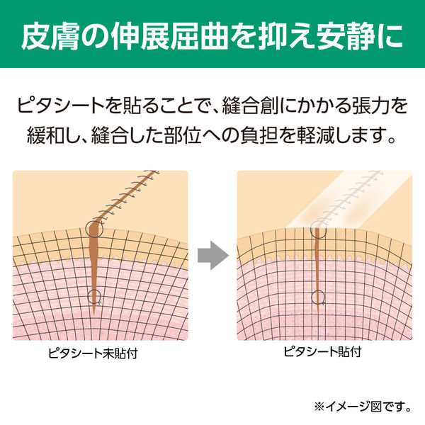 アルケア ピタシート ハード 19011 1箱（3枚入） （取寄品