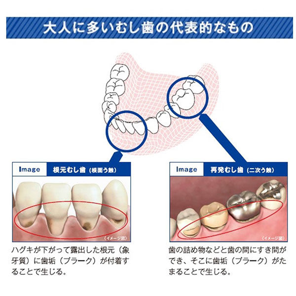 バトラー エフペースト α メディカルハーブ 90g 1セット（2本） サンスター BUTLER 歯磨き粉 高濃度フッ素 1450ppm 虫歯 口臭