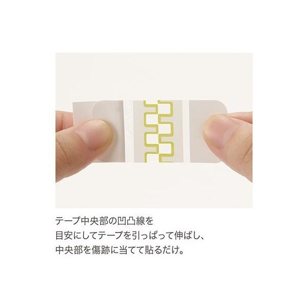 共和 アトレスケア(傷跡ケア専用テープ) 50×50mm 30枚 No.M30 1箱(30枚
