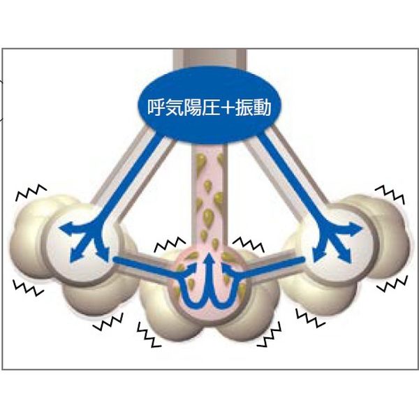 ICU メディカル アカペラ グリーン(成人用) 21-1530 1箱（取寄品