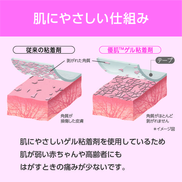 ニトムズ (優肌)パーミロール 14R05 1巻 フィルムドレッシング ニトムズ (優肌)パーミロール 14R05 1巻 フィルムドレッシング