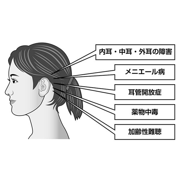 文響社 耳鳴り難聴 耳鼻咽喉科の名医が教える最高の治し方大全 1328 1