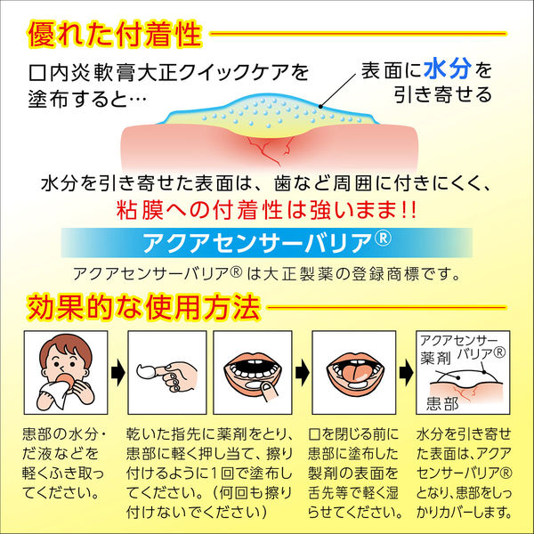 口内炎軟膏大正クイックケア 5g 大正製薬 ステロイド 塗り薬 口内炎【指定第2類医薬品】 - アスクル