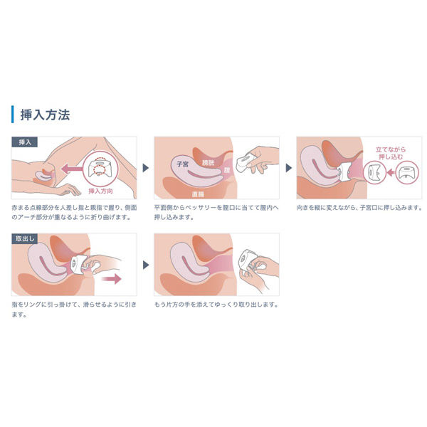 チェリー骨盤帯 臨床の専門的技能とリサーチの統合 北里ヘルスケア キタザトリングペッサリーK型 KRP-70-K 骨盤臓器
