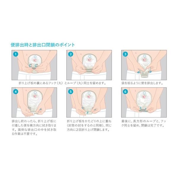 コロプラスト センシュラ1 プラス ナチュラル 肌色 25mm 15633 1箱(10