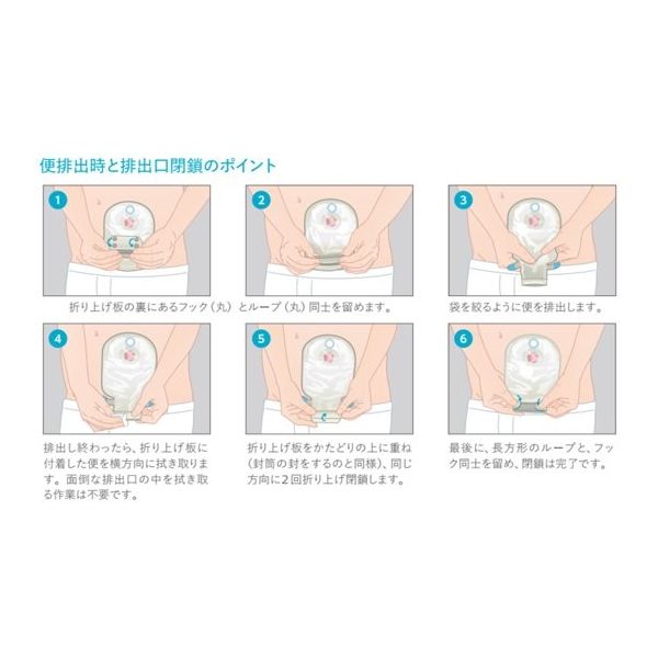 コロプラスト　センシュラ１イレオXproプラス　4箱セット センシュラ1イレオXproプラス 5枚/箱 19100 19110 19120 19130