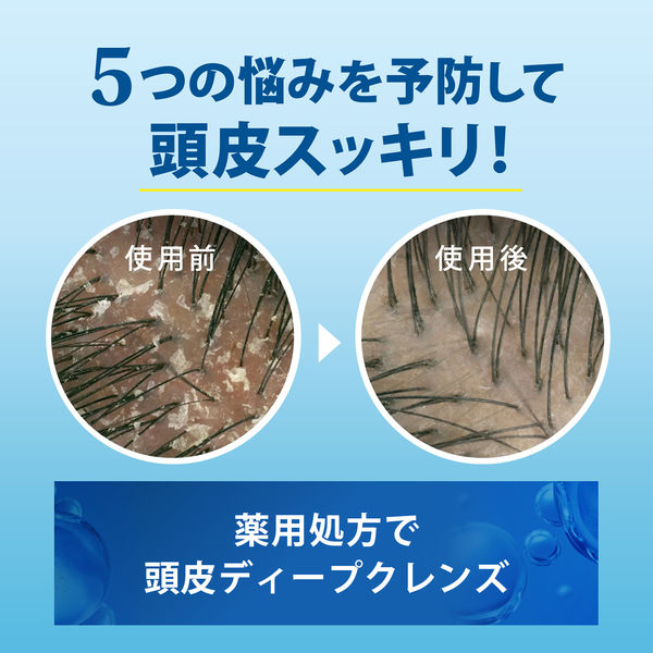 h＆s（エイチアンドエス）5in1 コンデイショナー 詰め替え 超