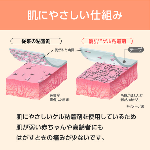ニトムズ 優肌絆不織布(肌) 3255 1箱(6巻入) サージカルテープ