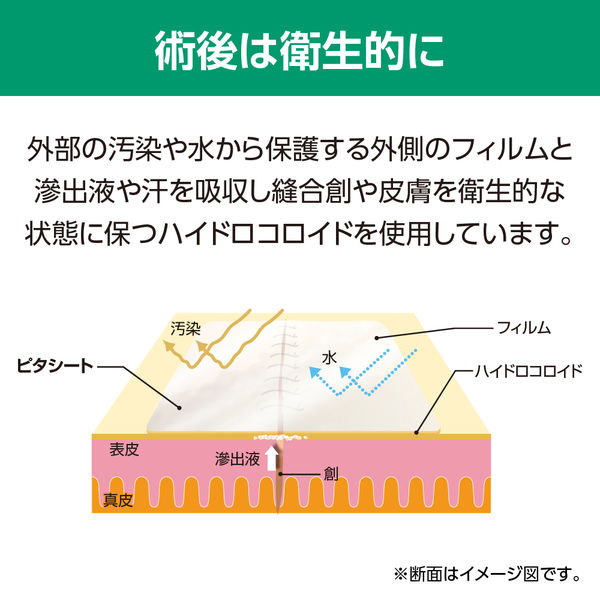 ERでの創処置 縫合・治療のスタンダード 原著第4版 | Alexander