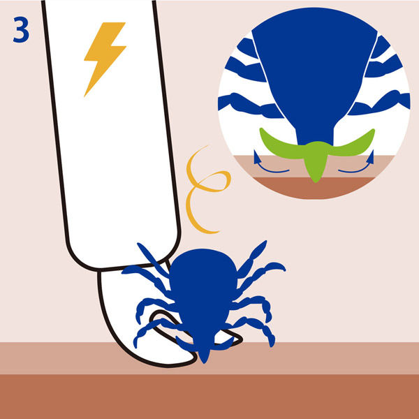 auvex(オーベックス) 電気マダニ除去器具 エレクティック AP10220000 6個（直送品） auvex オーベックス