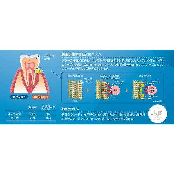 歯科医院取扱品 チェックアップ ルートケア 90g 1セット（2本） ライオン(LION) 歯磨き粉