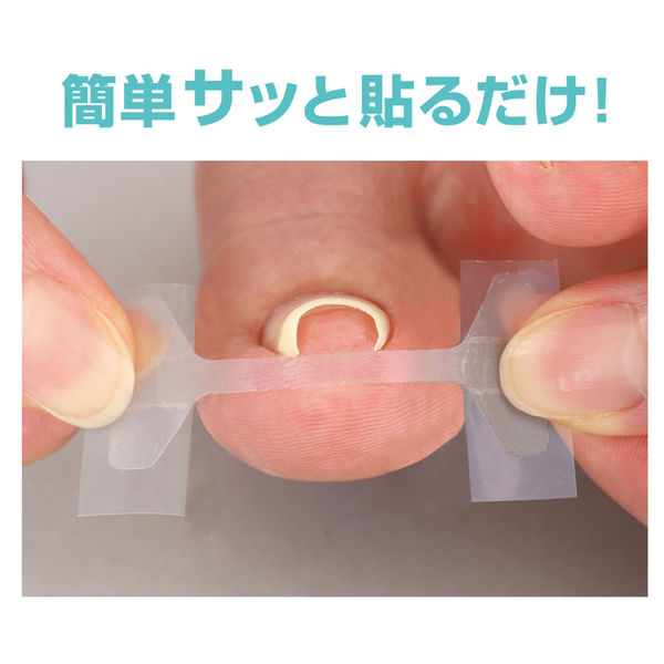 B/Sブレイス巻き爪用テープ ネイリストプロ用 サイプラス 透明巻き爪テープ ミエーヌ10枚入り 005992 1個 - アスクル