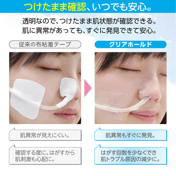 PSRポイントテープ療法 PSRポイントテープ療法 商品詳細ページ | メディカルブックセンター