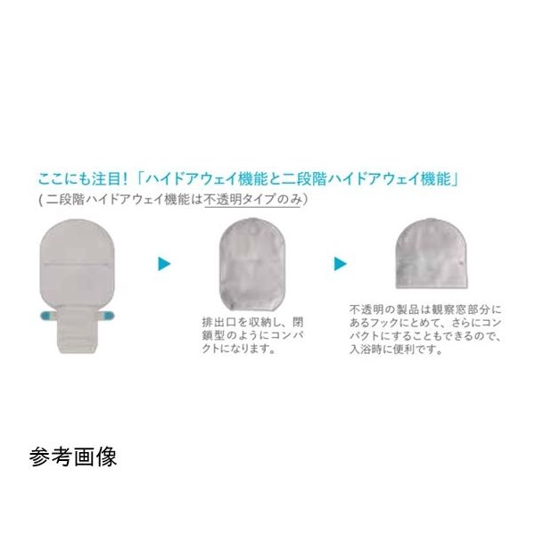 コロプラスト センシュラ1 イレオ Xpro プラス(観察窓付) 肌色