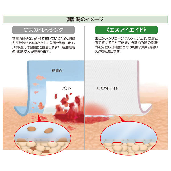 アルケア エスアイエイド 5号（10×10cm） 18752 1箱（50枚入） - アスクル