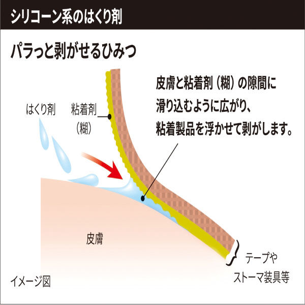 スリーエムジャパンキャビロン皮膚用リムーバーTP1_L50 - 衛生医療用品