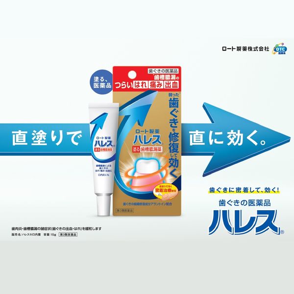 Amazon | 【第3類医薬品】ハレス口内薬 15g | ロート製薬 歯槽膿