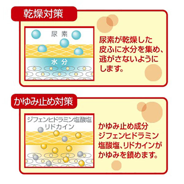 ウレパールプラスローション10 100ml 大塚製薬　かゆみ止め 保湿 塗り薬 かゆみを伴う乾燥肌に　【第2類医薬品】