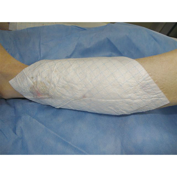 白十字 FCモイスキンパッド7510 M 7.5×10cm 5枚入 19097 1個 - アスクル