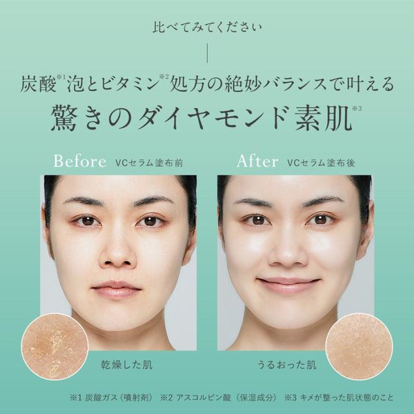 マイクロバブルVCセラム 90g 導入美容液 ビタミンC 美容液 保湿