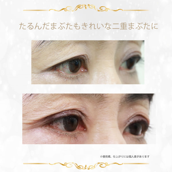ルドゥーブル プレミアム 2mL アーチブ - アスクル
