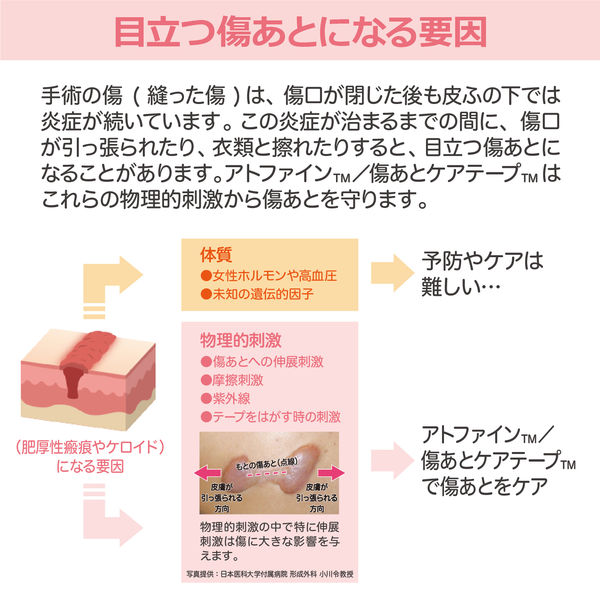 ニチバン アトファイン LLサイズ 4枚入 アトファイン LLサイズ ( 4枚入 ) : 爽快ドラッグ - 通販