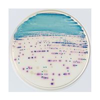 BD BBL(TM) CHROMagar(TM) オリエンテーション寒天培地 100枚 252086 1個(100本)（直送品）