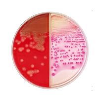 BD BBL(TM) コロンビアCNA5%ヒツジ血液寒天培地/マッコンキーII寒天培地 20枚 251600 1個(20本)（直送品）