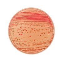 日本ベクトン・ディッキンソン BD BBL(TM) マッコンキーII寒天培地 100枚 251270 1個(100本) 63-6527-05（直送品）