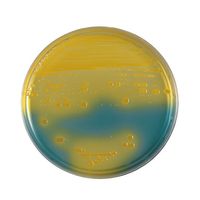 日本ベクトン・ディッキンソン BD BBL(TM) BTB乳糖加寒天培地 100枚 251251 1個(100本) 63-6527-07（直送品）