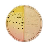 BD BBL(TM) 変法サルモネラ・シゲラ寒天培地/CTーソルビトール添加マッコンキーII寒天培地 LDIP 100枚 251513（直送品）