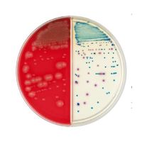 BD BBL(TM) TSAII5%ヒツジ血液寒天培地/CHROMagar(TM) オリエンテーション寒天培地 100枚 252075（直送品）
