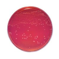 日本ベクトン・ディッキンソン BD BBL(TM) スキロー培地 20枚 252111 1個(20本) 63-6527-58（直送品）