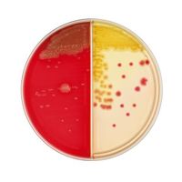 BD BBL(TM) TSAII5%ヒツジ血液寒天培地/DHL寒天培地 100枚 252022 1個(100本)（直送品）
