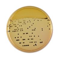 日本ベクトン・ディッキンソン BD BBL(TM) サルモネラ・シゲラ寒天培地 20枚 251181 1個(20本) 63-6527-11（直送品）