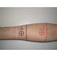 中部メディカル 放射線治療用フィールドマーカー 十字(90枚) 黒 86512002 1箱(90枚入) 23-2663-04-02（直送品）