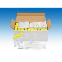 松浪硝子工業 カクタンサンプラー 蓄痰法 L 50mL 保存液30mL入 50本入 NNL0050 1箱(50本) 67-8064-97（直送品）